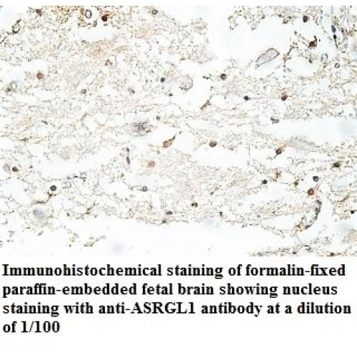 ASRGL1 Antibody