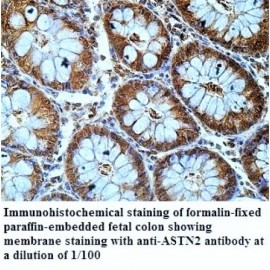 ASTN2 Antibody