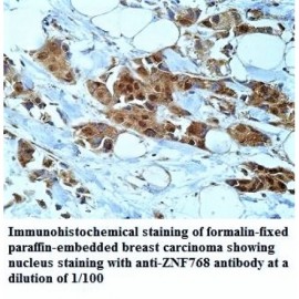 ZNF768 Antibody