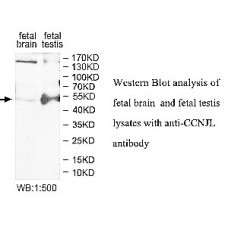 ASTL Antibody