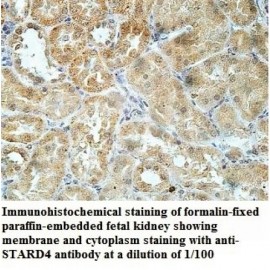 STARD4 Antibody