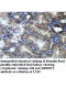 ARRDC3 Antibody