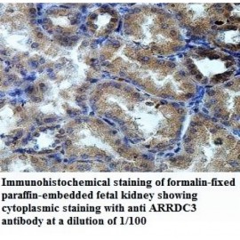 ARRDC3 Antibody