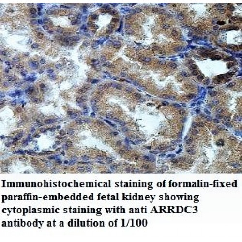 ARRDC3 Antibody