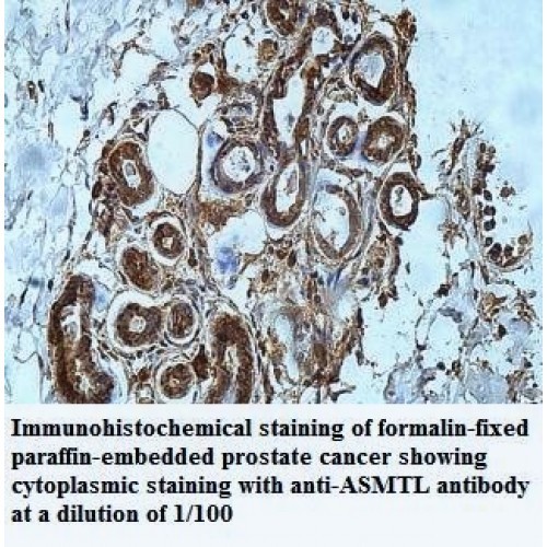 ASMTL Antibody