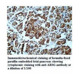 STARD4 Antibody