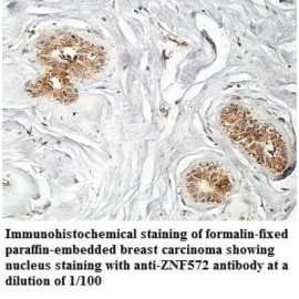 ZNF572 Antibody