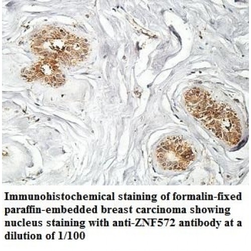 ZNF572 Antibody