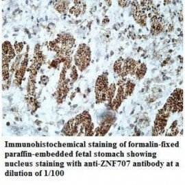 ZNF707 Antibody
