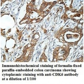CDK6 Antibody