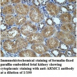 ARMC1 Antibody