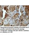 ARMC3 Antibody