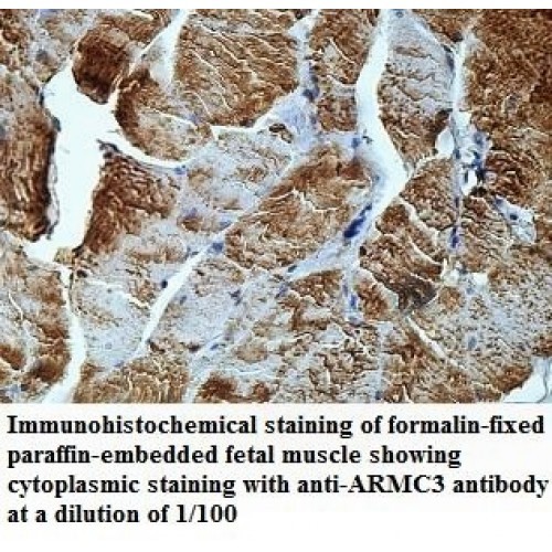 ARMC3 Antibody