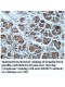 ARMC5 Antibody