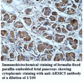 ARMC5 Antibody