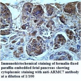 ARMC7 Antibody