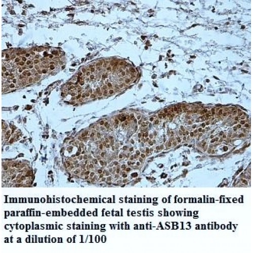 ASB13 Antibody