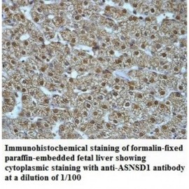 ASNSD1 Antibody