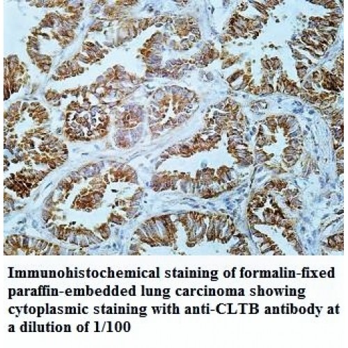 CLTB Antibody