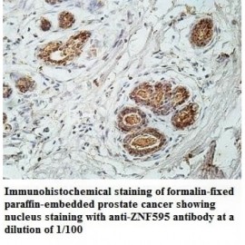 ZNF595 Antibody