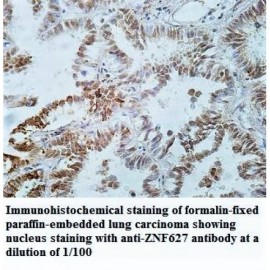 ZNF627 Antibody
