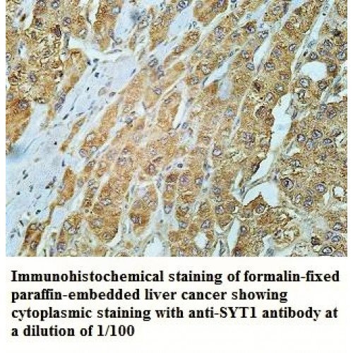 SYT1 Antibody