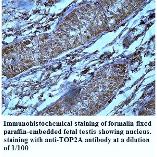 TOP2A Antibody