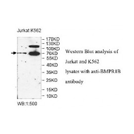 ZNF595 Antibody
