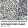 ASF1A Antibody