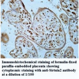 Sirtuin2 Antibody