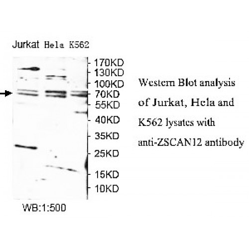 ZSCAN12 Antibody