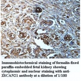 ZSCAN21 Antibody