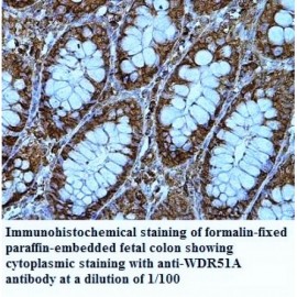 WDR51A Antibody