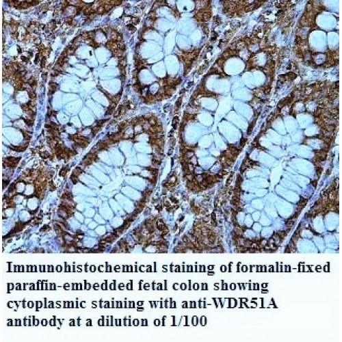 WDR51A Antibody