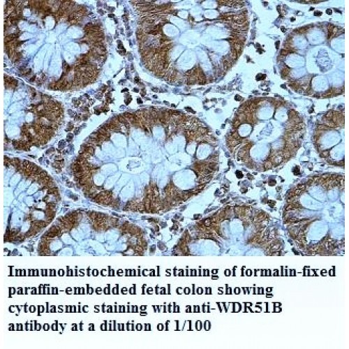 WDR51B Antibody