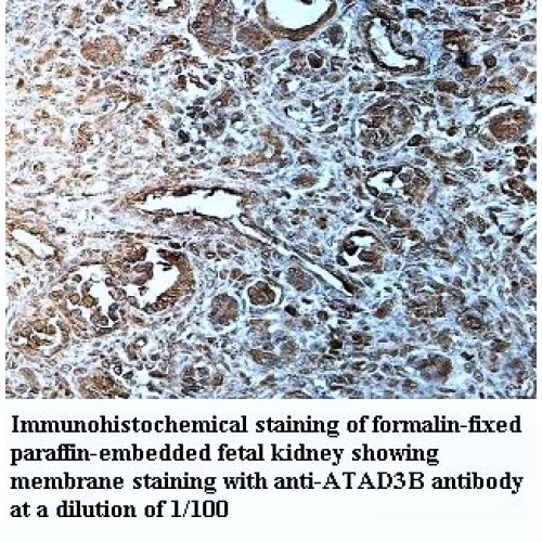 ATAD3B Antibody