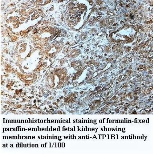 ATP1B1 Antibody