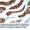 ATG4A Antibody