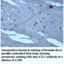 ATL1 Antibody