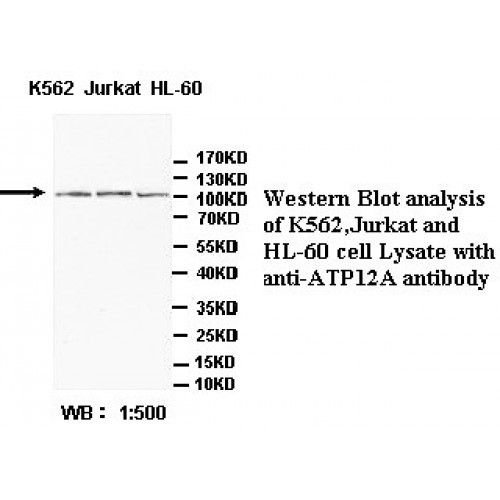 ATP12A Antibody