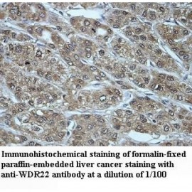 WDR22 Antibody