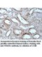 MIPOL1 Antibody