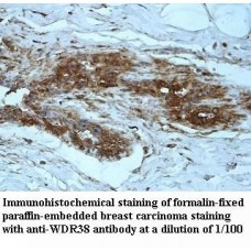 WDR31 Antibody