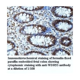 WDR31 Antibody