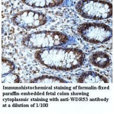 WDR31 Antibody