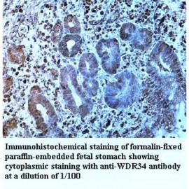 WDR34 Antibody