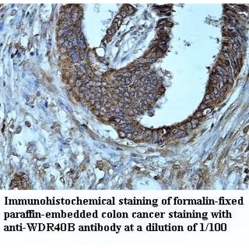 WDR40B Antibody