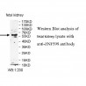 ZNF599 Antibody