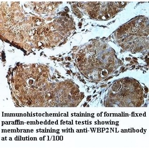 WBP2NL Antibody