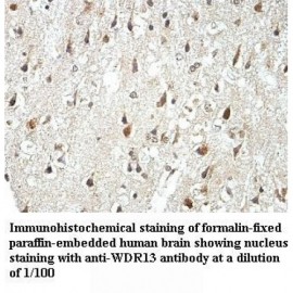 WDR13 Antibody